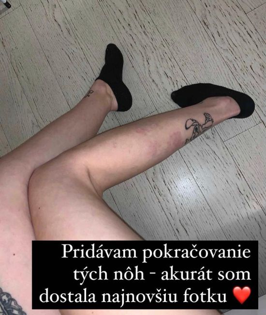 Obrázok 106