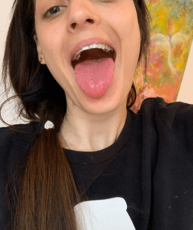 Obrázok 4