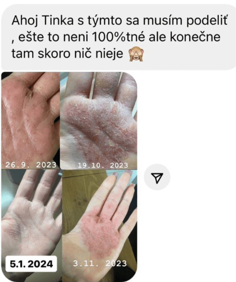 Obrázok 5