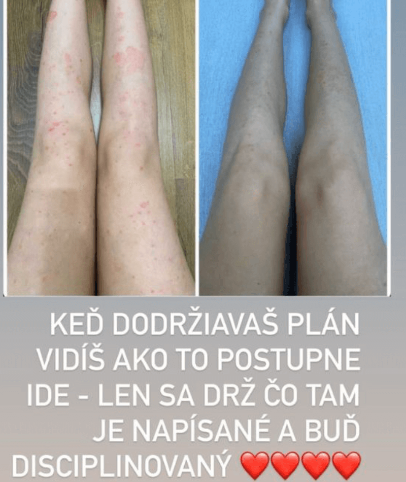 Obrázok 6